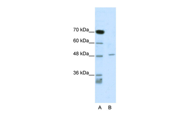 CACNB4 Rabbit Polyclonal Antibody
