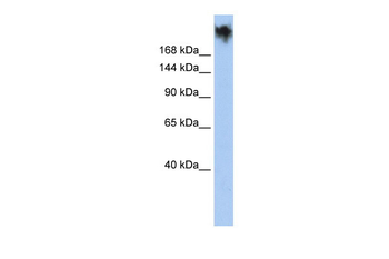 PKDREJ Rabbit Polyclonal Antibody