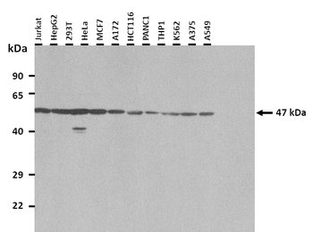 CLIC5 Rabbit Polyclonal Antibody