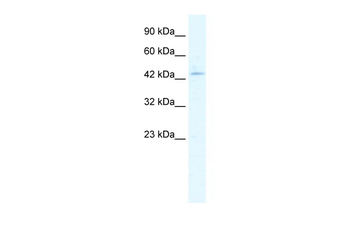 CLIC5 Rabbit Polyclonal Antibody