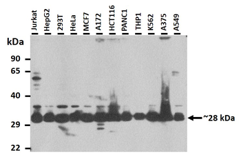 CLIC5 Rabbit Polyclonal Antibody