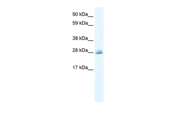 CLIC5 Rabbit Polyclonal Antibody