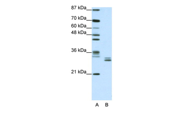 CLIC5 Rabbit Polyclonal Antibody