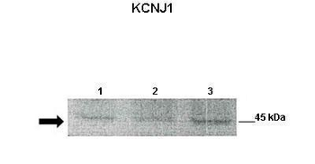 KCNJ1 Rabbit Polyclonal Antibody
