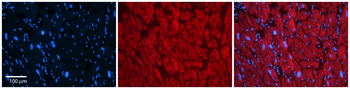 KCNAB2 Rabbit Polyclonal Antibody