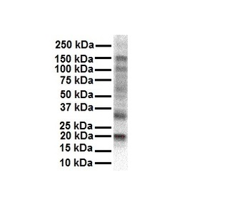 KCNAB2 Rabbit Polyclonal Antibody