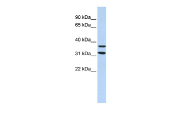 ZNF254 Rabbit Polyclonal Antibody
