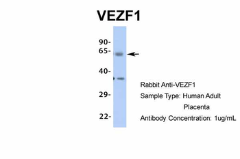 VEZF1 Rabbit Polyclonal Antibody
