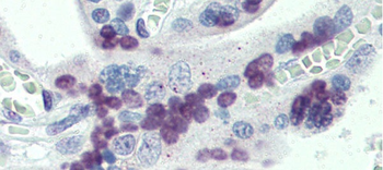 PRDM9 Rabbit Polyclonal Antibody