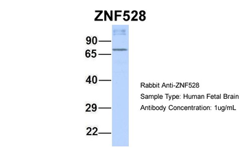ZNF528 Rabbit Polyclonal Antibody