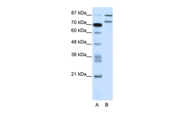 ZNF709 Rabbit Polyclonal Antibody