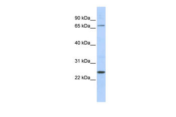 ZNF835 Rabbit Polyclonal Antibody