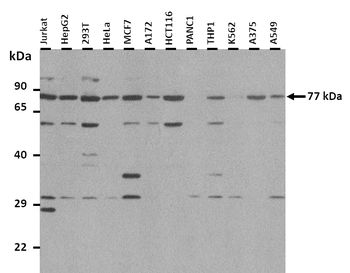 TWNK Rabbit Polyclonal Antibody