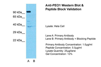 TWNK Rabbit Polyclonal Antibody