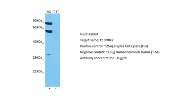 TWNK Rabbit Polyclonal Antibody