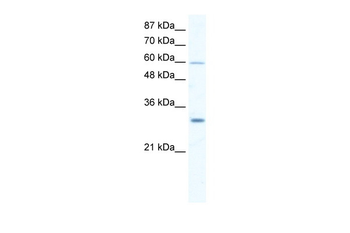 DDX31 Rabbit Polyclonal Antibody