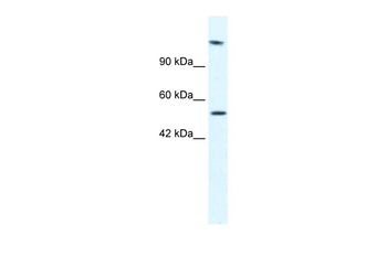 HELB Rabbit Polyclonal Antibody