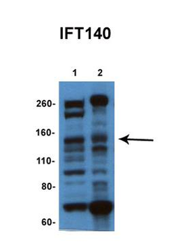 IFT140 Rabbit Polyclonal Antibody