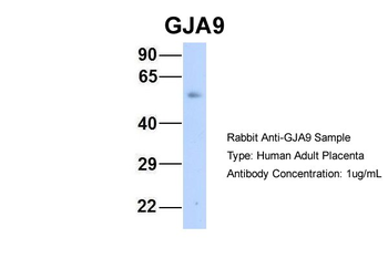 GJA9 Rabbit Polyclonal Antibody
