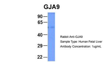 GJA9 Rabbit Polyclonal Antibody
