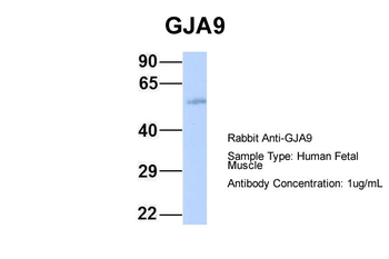 GJA9 Rabbit Polyclonal Antibody