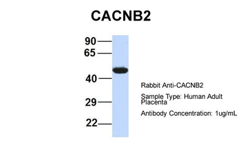 CACNB4 Rabbit Polyclonal Antibody