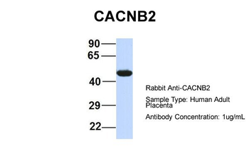 CACNB4 Rabbit Polyclonal Antibody