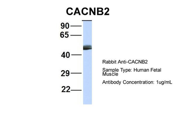CACNB4 Rabbit Polyclonal Antibody