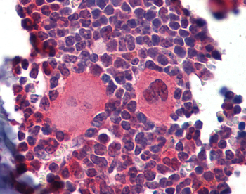 Nkx2-3 Rabbit Polyclonal Antibody