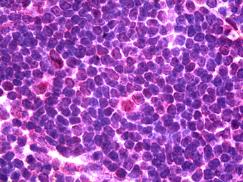 Nkx2-3 Rabbit Polyclonal Antibody