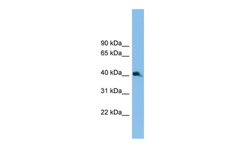 Nkx2-3 Rabbit Polyclonal Antibody