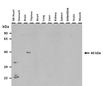 Tsc22d4 Rabbit Polyclonal Antibody