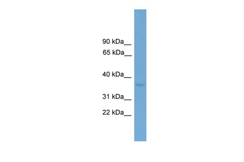Zfp444 Rabbit Polyclonal Antibody