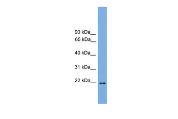 Jundm2 Rabbit Polyclonal Antibody