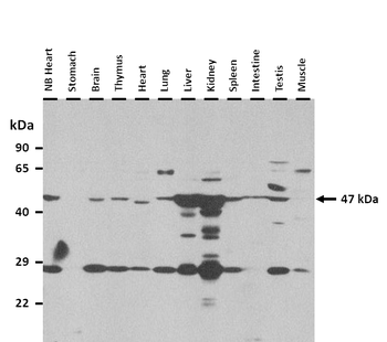 A630025C20RIK Rabbit Polyclonal Antibody
