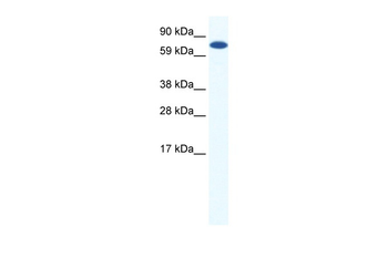 CBFA2T2H Rabbit Polyclonal Antibody
