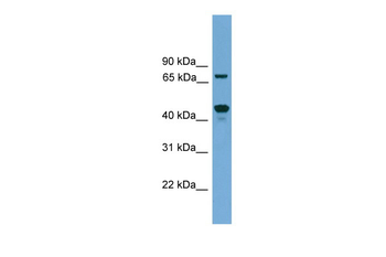 Zkscan17 Rabbit Polyclonal Antibody
