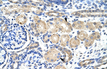 KCNAB2 Rabbit Polyclonal Antibody