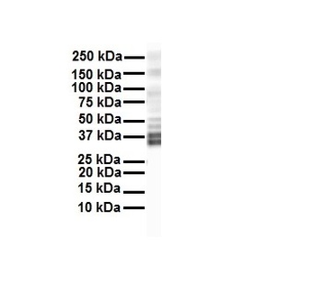 KCNAB2 Rabbit Polyclonal Antibody