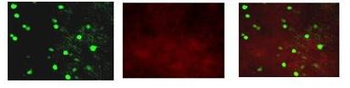 KCNAB2 Rabbit Polyclonal Antibody