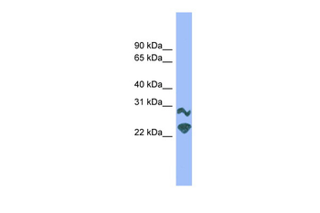 Prrxl1 Rabbit Polyclonal Antibody