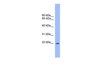 Prrxl1 Rabbit Polyclonal Antibody