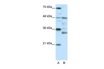 HTLF Rabbit Polyclonal Antibody