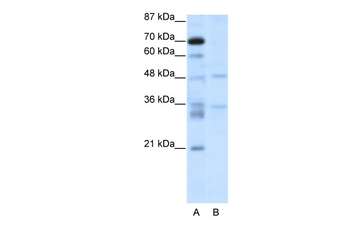 HTLF Rabbit Polyclonal Antibody