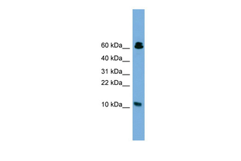 SUPT4H1 Rabbit Polyclonal Antibody