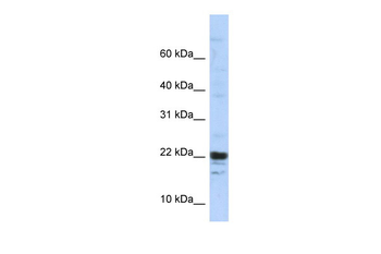 KIAA0040 Rabbit Polyclonal Antibody