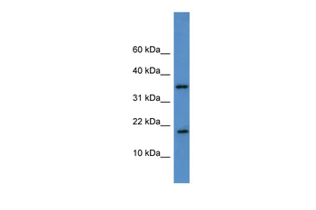 TCEAL9 Rabbit Polyclonal Antibody