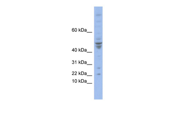 POLE4 Rabbit Polyclonal Antibody