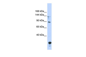 TULP4 Rabbit Polyclonal Antibody