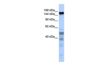 ZNF335 Rabbit Polyclonal Antibody